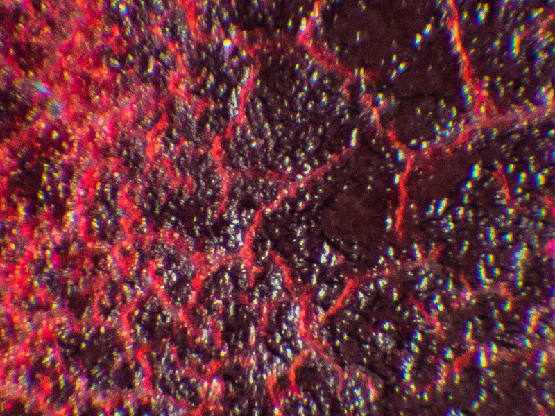 Кровь Под Микроскопом Фото
